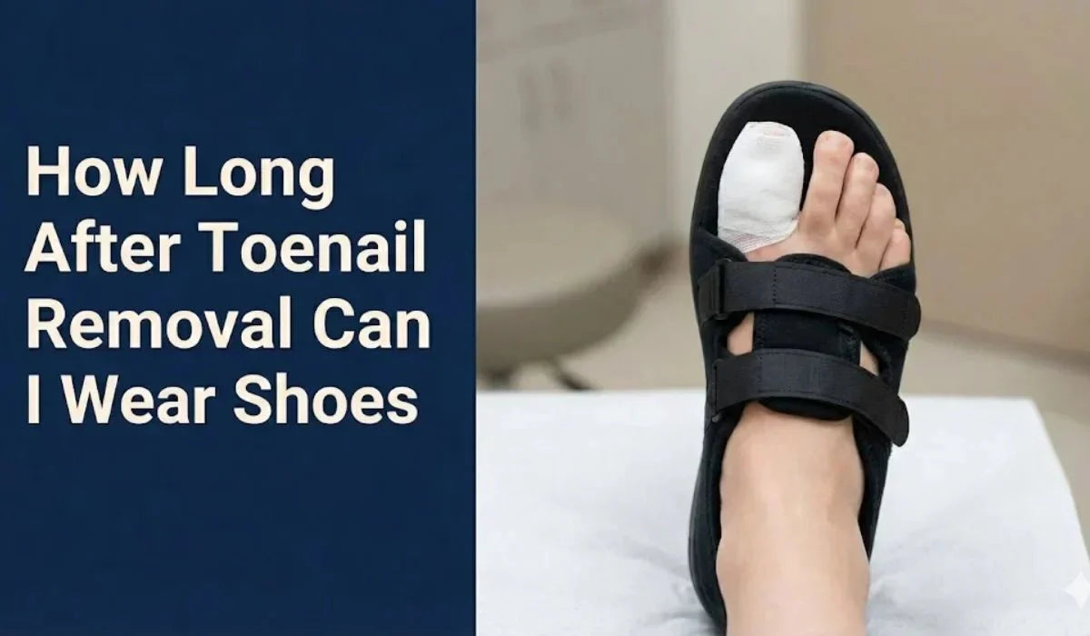 How Long After Toenail Removal Can I Wear Shoes - Absanoh Pakistan